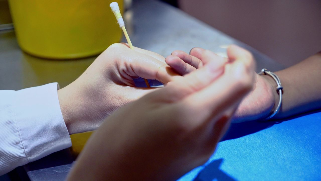 抽血采血化验检验
