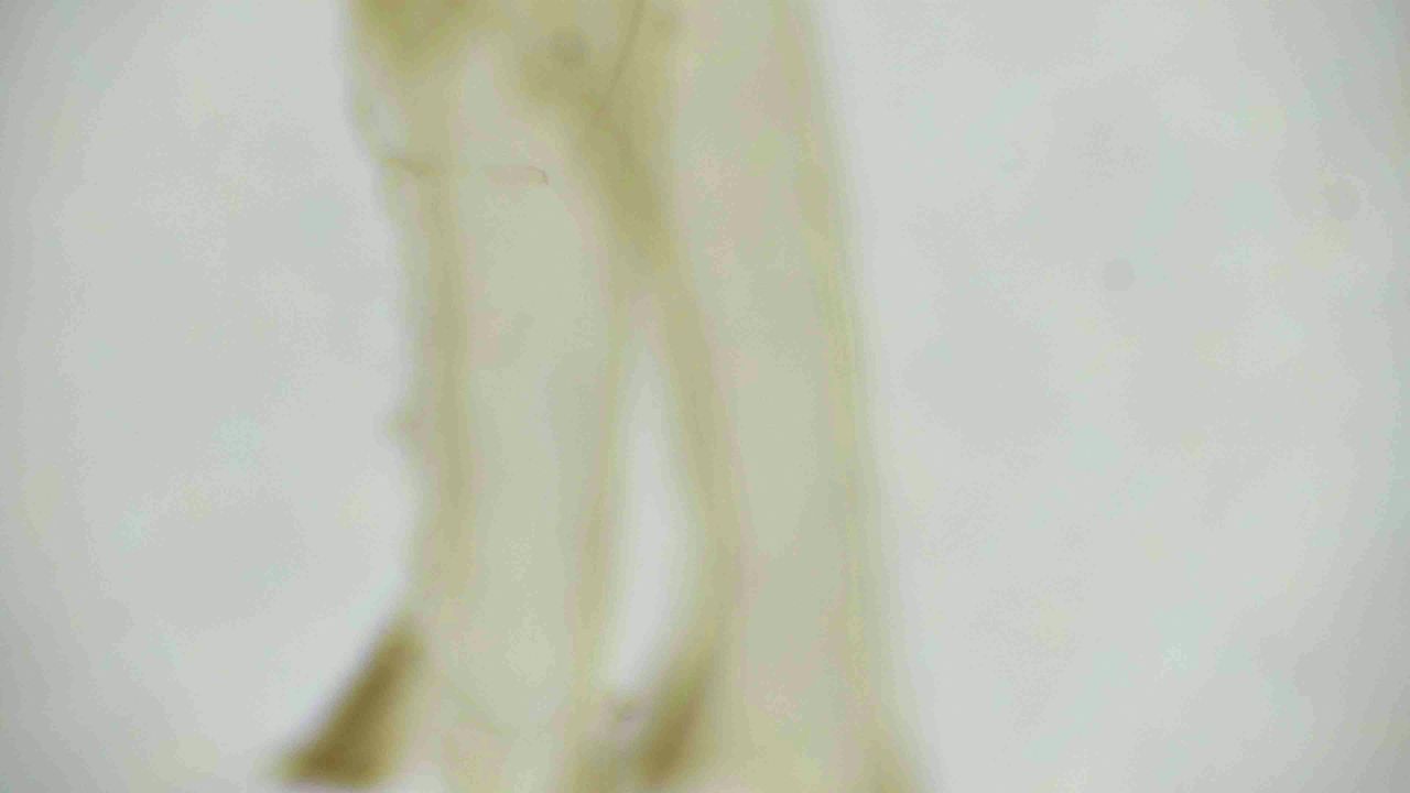 显微镜拍摄的蜻蜓腿标本