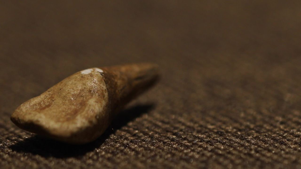 博物馆人类牙齿
